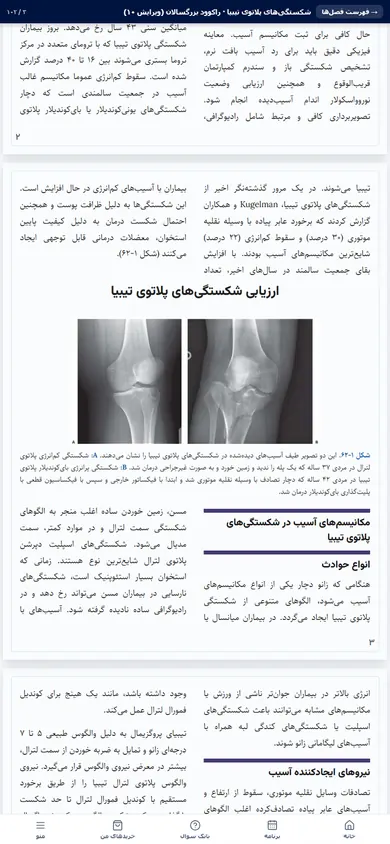 تصویر واقعی ترجمه آینه‌ای در پنل ارتوپدی دیباطب