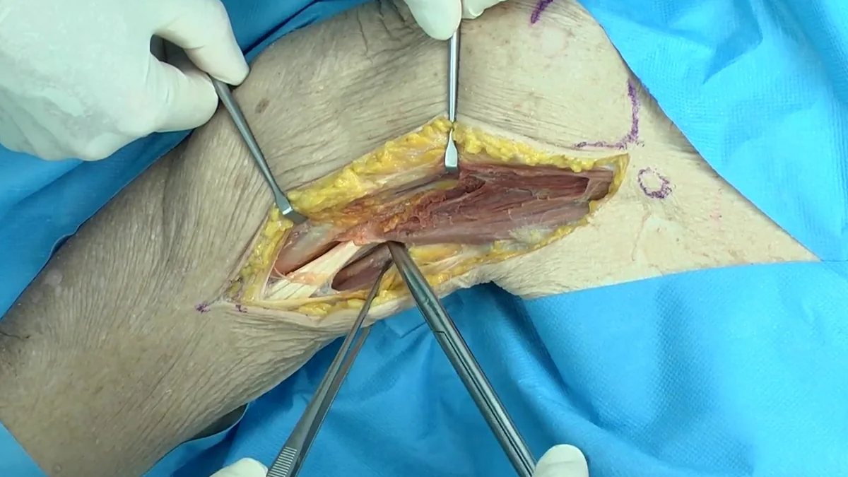 دوره‌های ویدیویی Incision در پنل ارتوپدی دیباطب