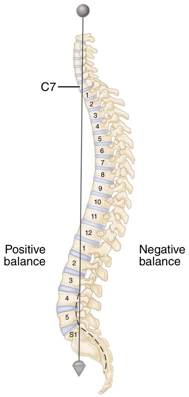 Figure 41.1