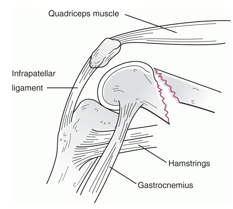 Figure 58-1