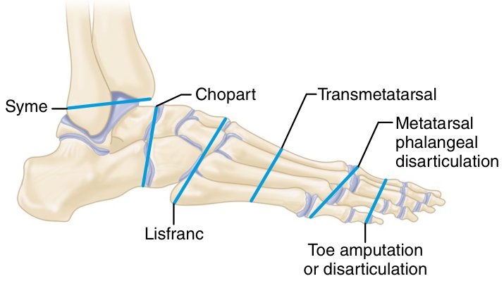Figure 17.1